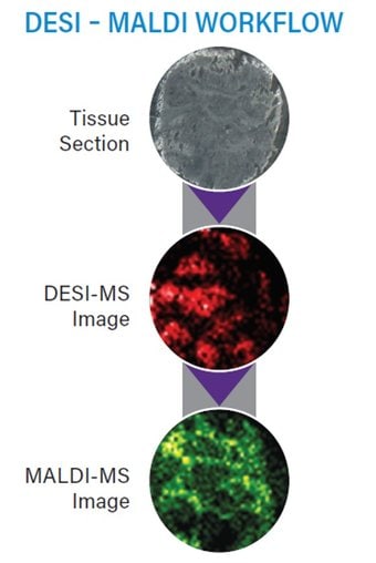 Repeat analysis of the same tissue sample using DESI imaging followed by MALDI imaging, highlighting the flexibility of DESI to fit into existing workflows, and the complementary nature of the two imaging techniques.