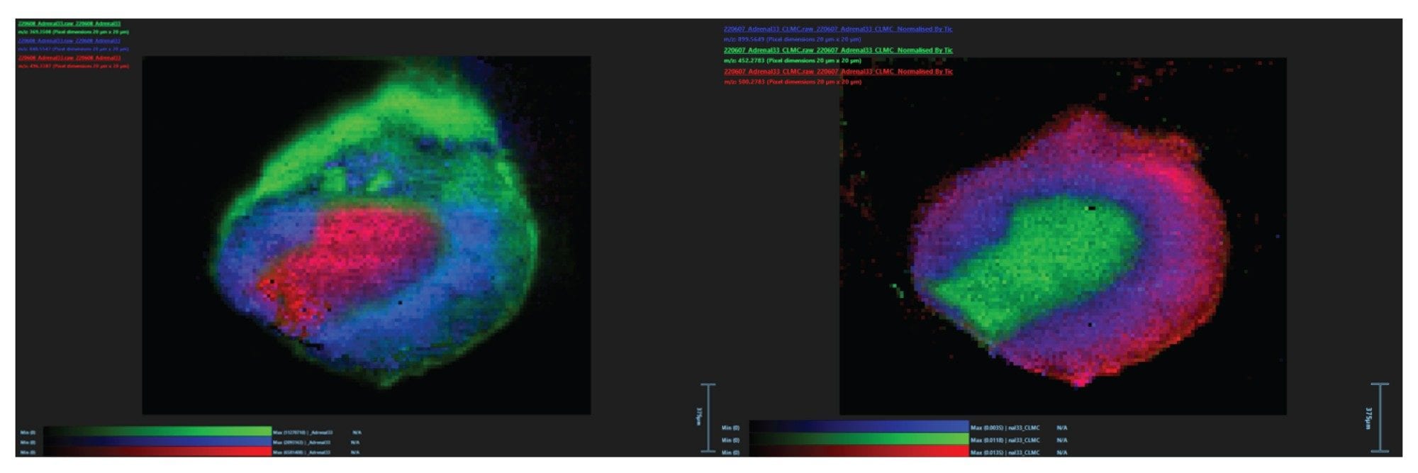 Example images for positive ionisationionization mode (Left) and negative ionisationionization mode (Right) (TIC normalized) of murine adrenal tissue sections analysedanalyzed by DESI MSI on the MRT